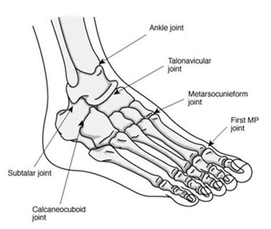 artritis reumatoide en los pies