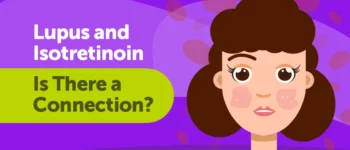 Lupus and Isotretinoin: Is There a Connection?