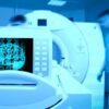 Does MRI Show Blood Clots? Understanding the Use and Effectiveness of MRI Technology