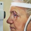 Eye Care Physicians & Surgeons: Discussing Floaters, Glaucoma and Eye Care