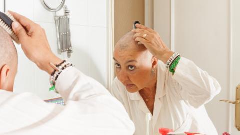 coconut oil for chemo scalp