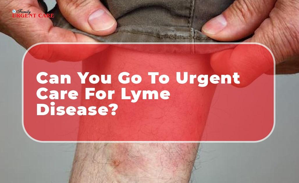 does urgent care do lyme testing