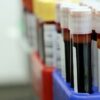 How Many Vials of Blood in a Pint? Guide for Phlebotomists and Donors