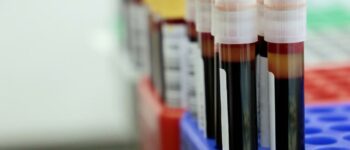 How Many Vials of Blood in a Pint? Guide for Phlebotomists and Donors