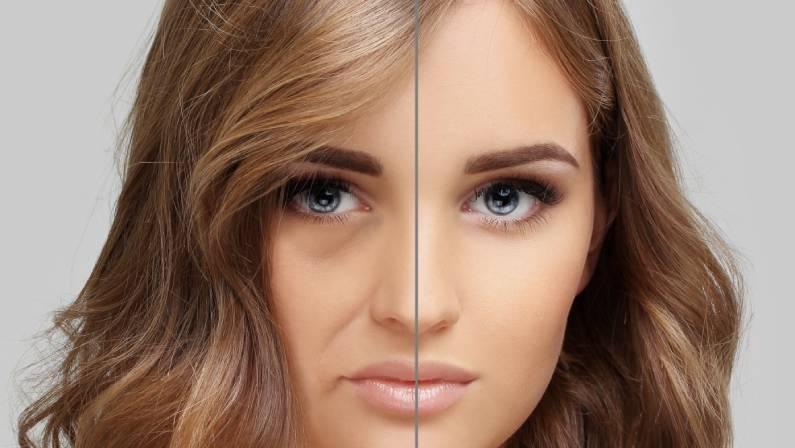 how to add volume to face without fillers