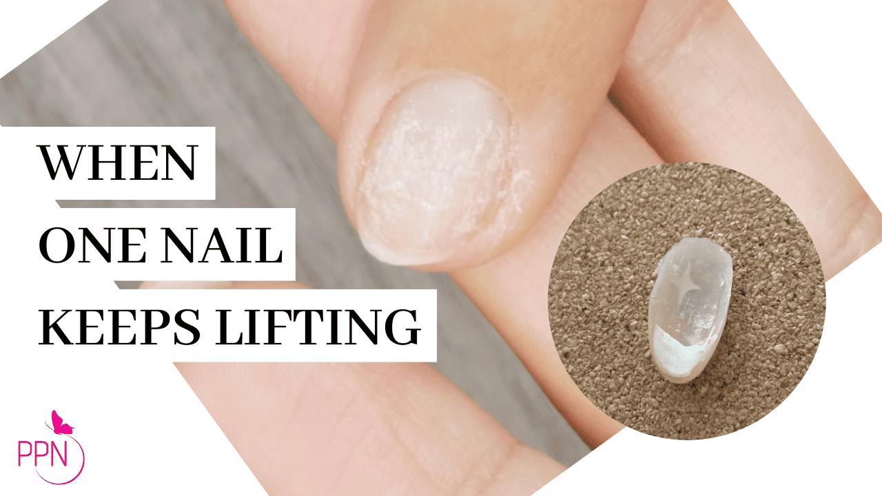 how to fix a lifting nail at home