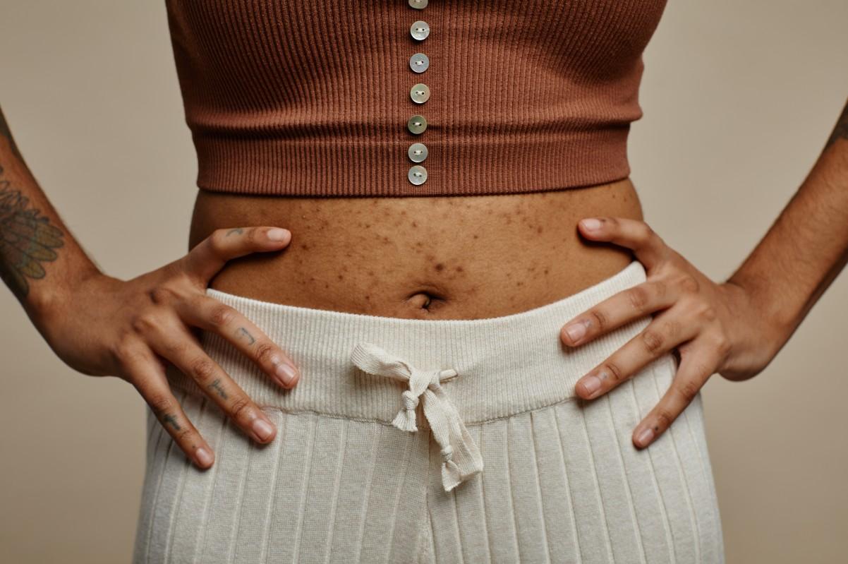 how to get rid of stomach pimples