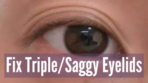 how to get rid of triple eyelids