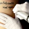 Laser Tattoo Removal – How to Prepare and What to Expect