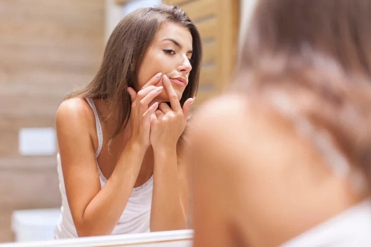 how to treat acne caused by laser hair removal