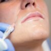 Journal Of Aesthetic Nursing - Dermal Fillers Supplement