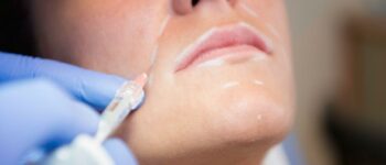 Journal Of Aesthetic Nursing - Dermal Fillers Supplement