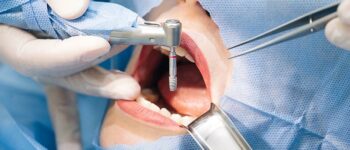 ICD-10 Codes to Report Common Dental Diseases