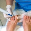 Natural Ingrown Toenail Treatments That Actually Work