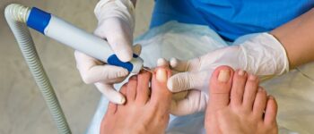 Natural Ingrown Toenail Treatments That Actually Work