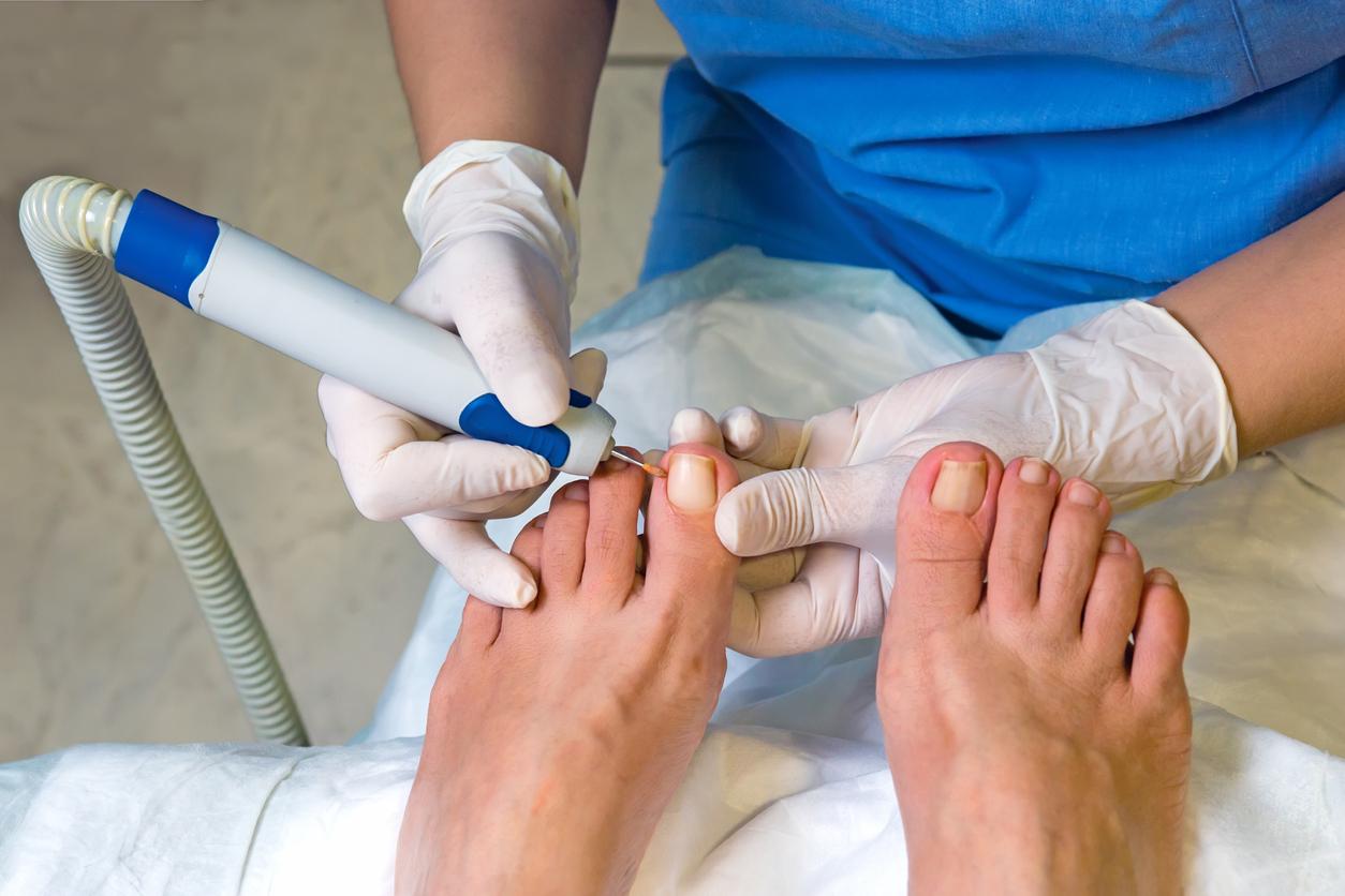 is neosporin good for ingrown toenails