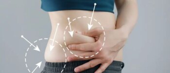 Kybella for Stomach Fat: Is it Effective?