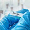 Coding Methicillin-resistant Staphylococcus Aureus (MRSA) Conditions