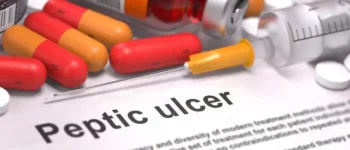 Peptic Ulcer – Symptoms, Diagnosis, and Assigning the Correct ICD-10 Codes