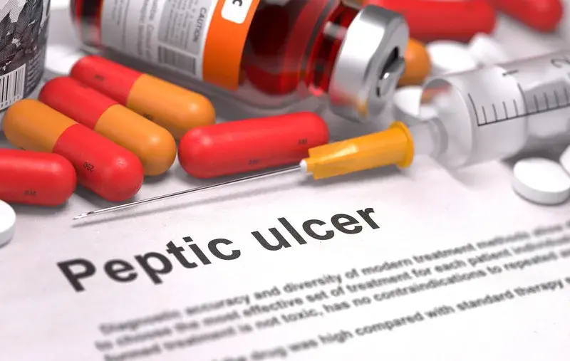 peptic ulcer icd 10 code