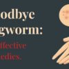 How to cure ringworm fast