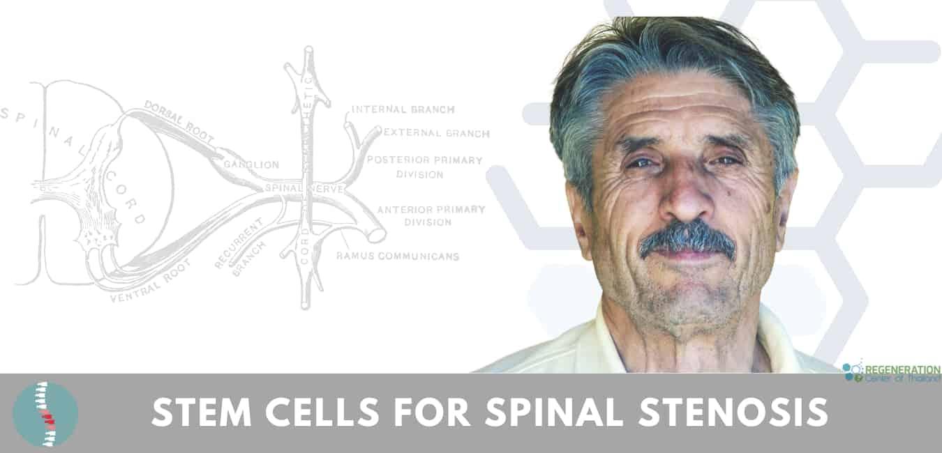 spinal stenosis and stem cell therapy