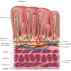 Is Stomach Wall Thickening Serious?