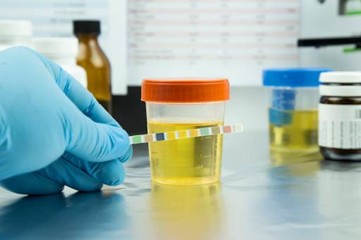 what is pcr urine test