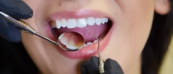 Dental Top 10 Dental Procedures & Their Function