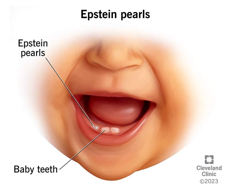 baby teeth with white spots