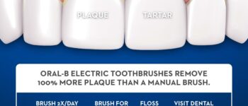 HOW TO GET RID OF PLAQUE AND REMOVE TARTAR BUILDUP