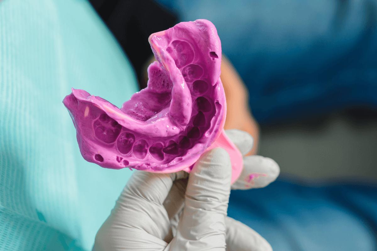 can dental impressions pull crowns out