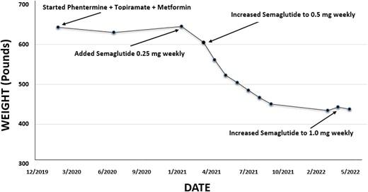 Weight Loss From Combination Anti-Obesity Medication Regimens Can Approach that Achieved From Bariatric Surgery