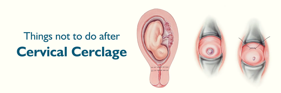 can i travel after cervical cerclage