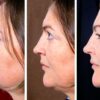 3 Surprising Causes of a Double Chin