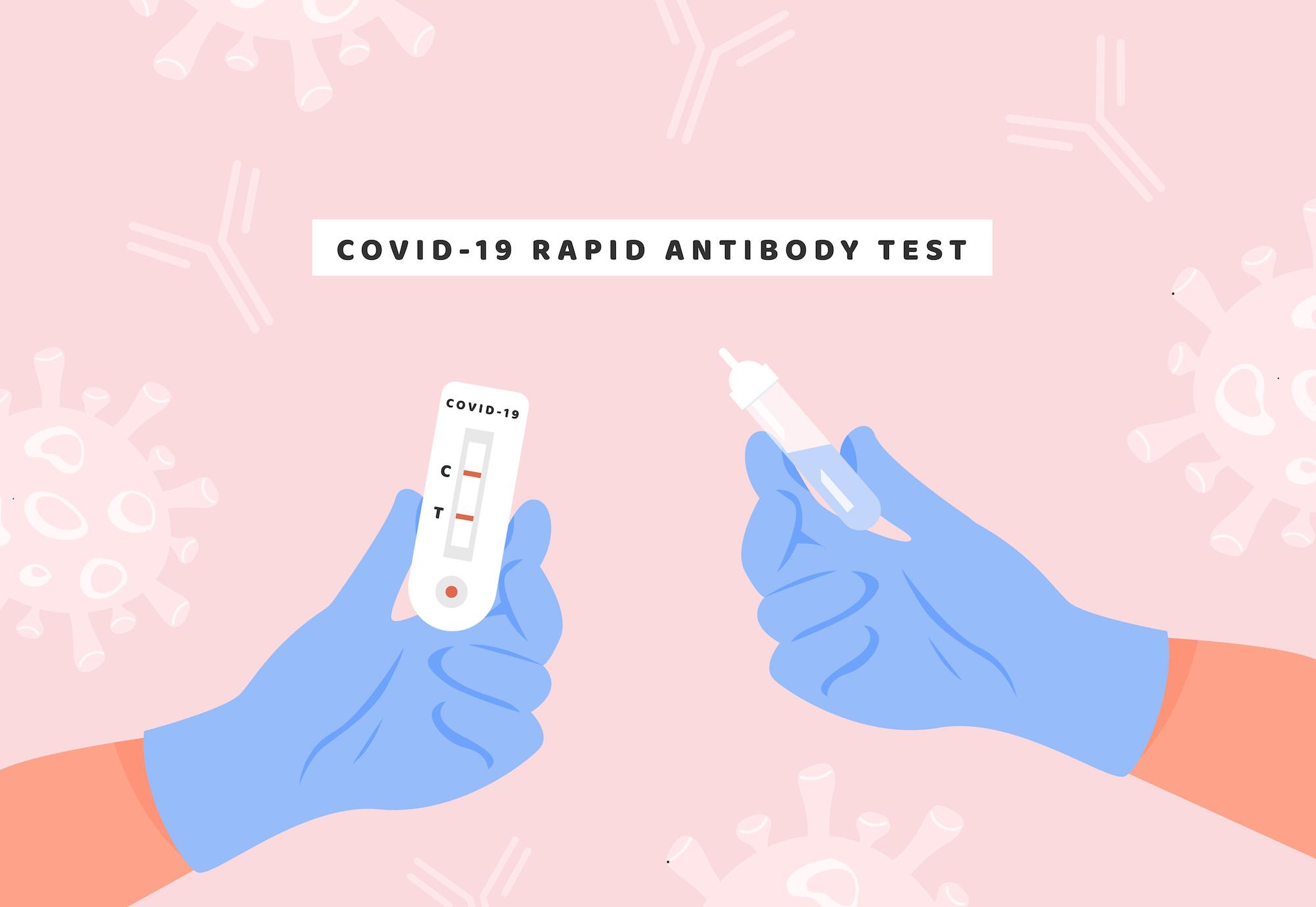 covid 19 antibody test illinois