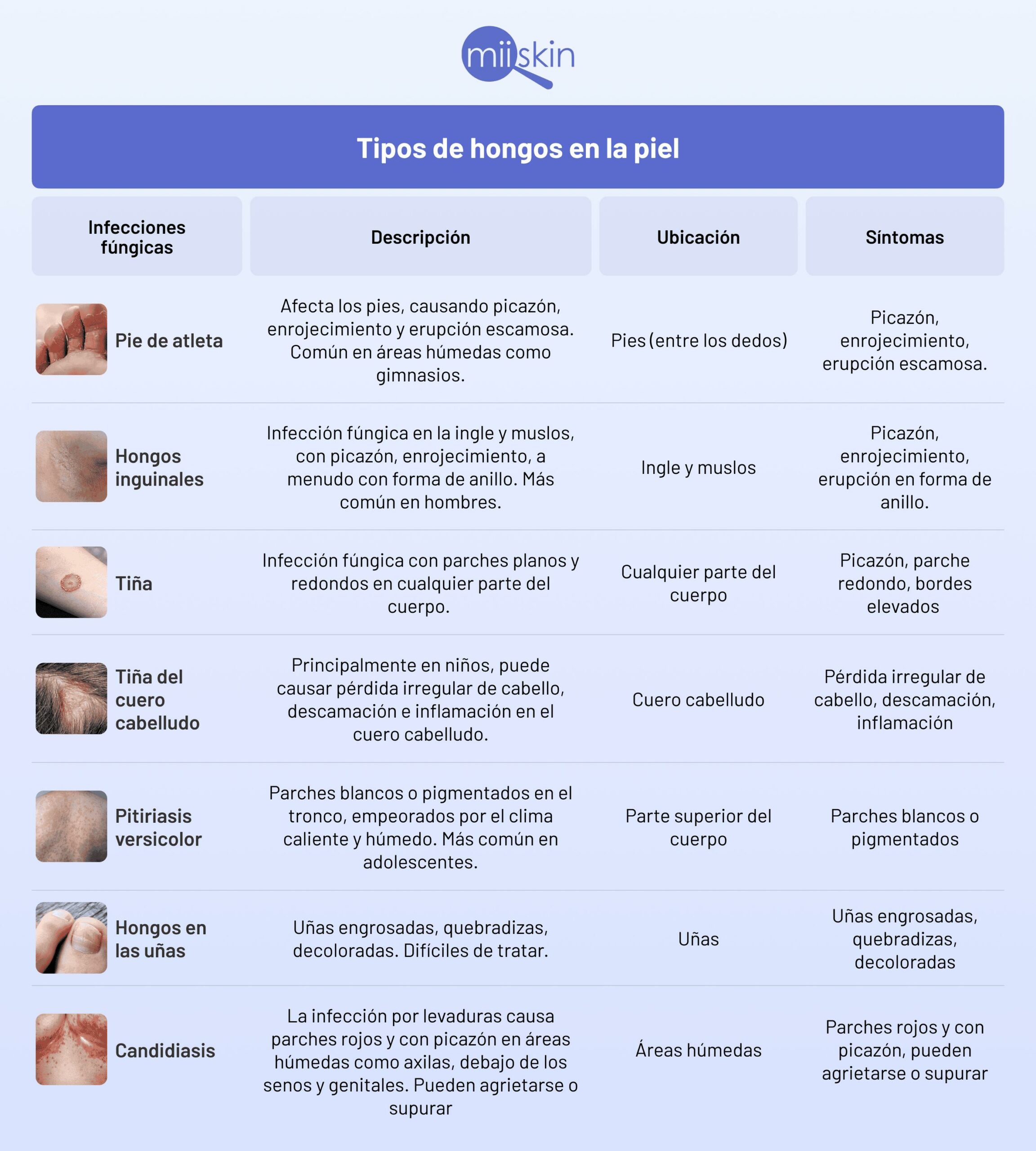 Hongos en la piel ¿Qué son y cuál es el mejor tratamiento? 