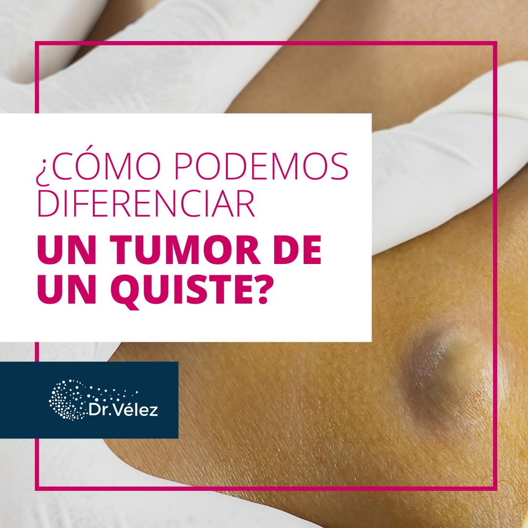 diferencia entre quiste y tumor