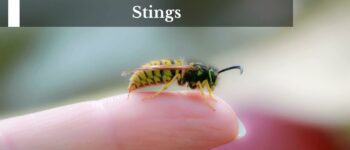 5 Essential Oils To Treat Bee Stings