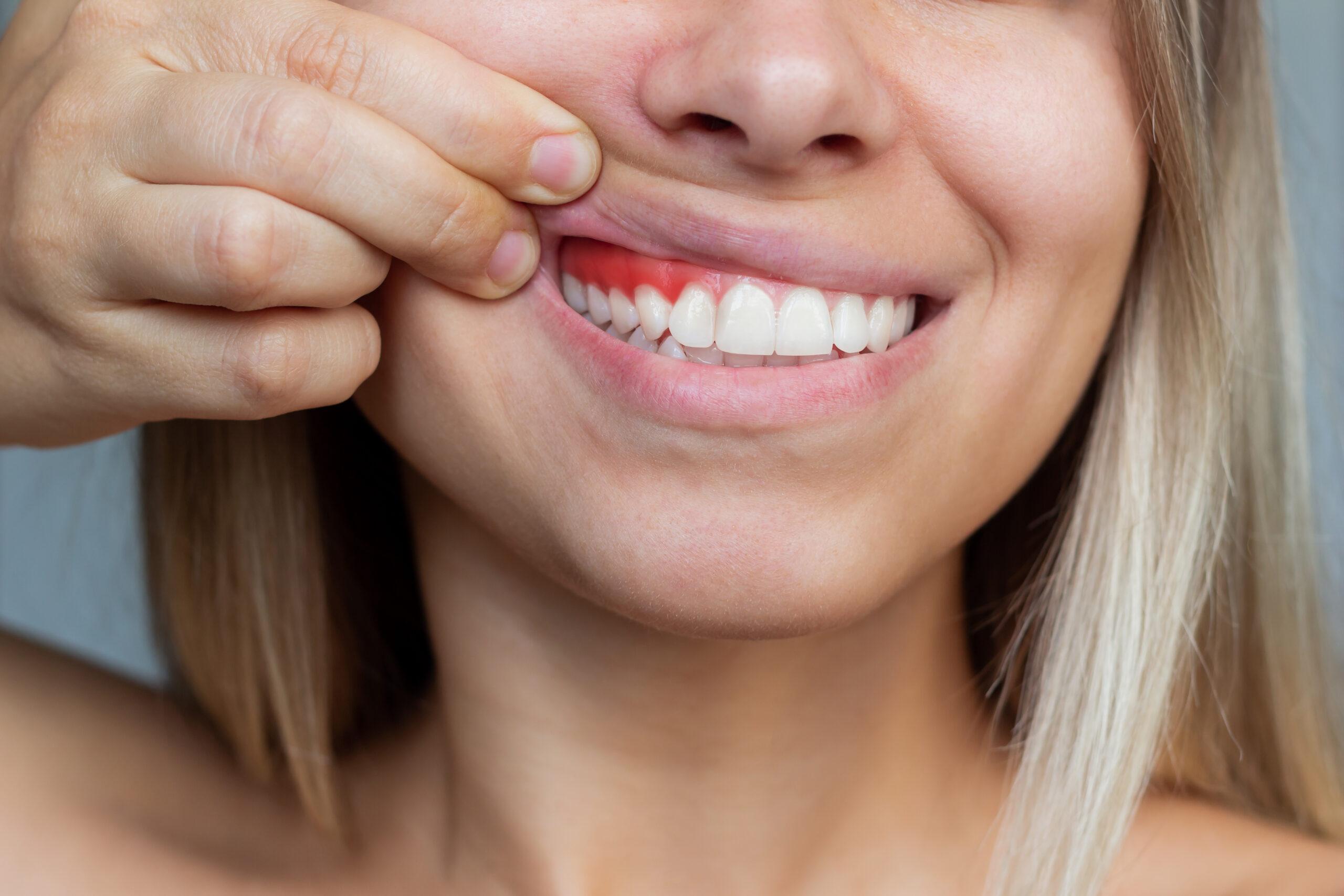 how long for cut gum to heal