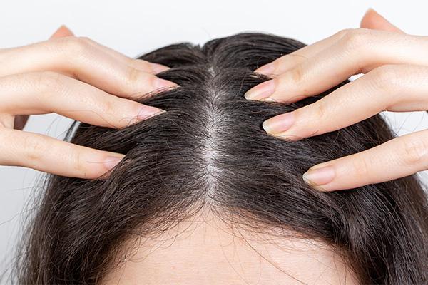 how to get dry blood out of hair