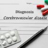 Top 5 Cerebrovascular Diseases and Their Related ICD-10 Codes