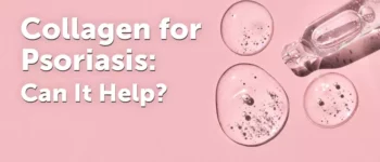 Collagen for Psoriasis: Can It Help?