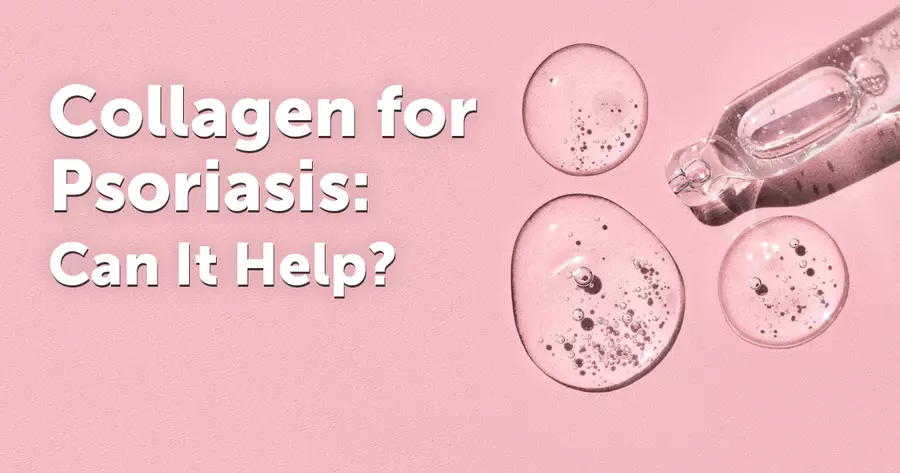 is collagen good for psoriasis