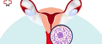 Mixed Urogenital Flora in Urine: Causes, Diagnosis & Impact