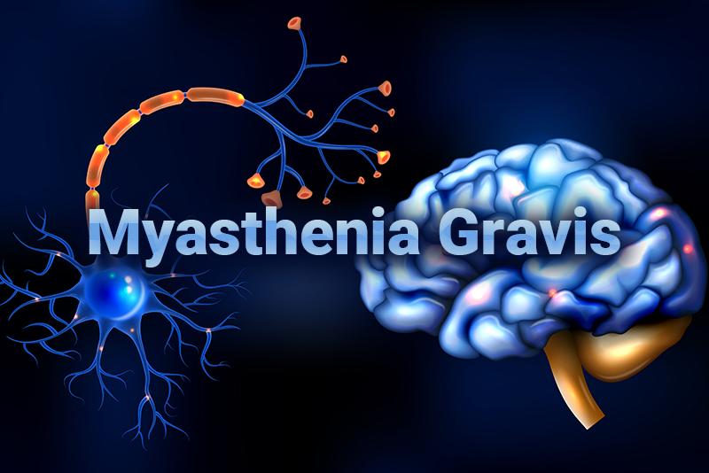 myasthenia gravis in crisis icd 10