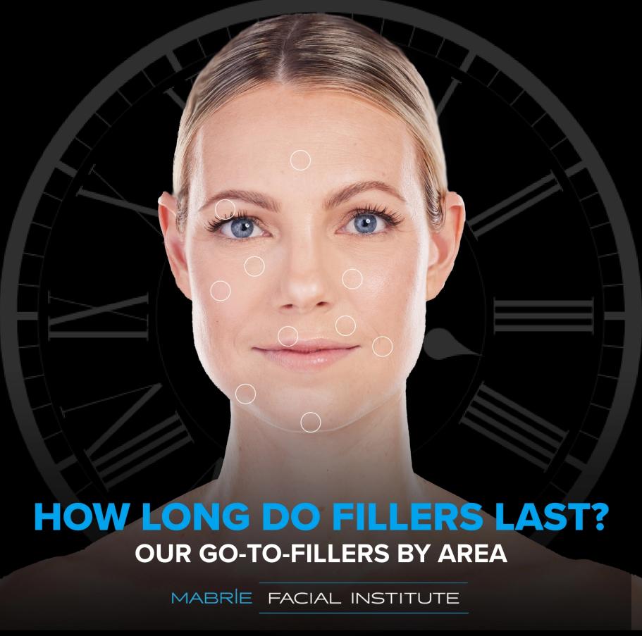 nasolabial fold filler how long does it last