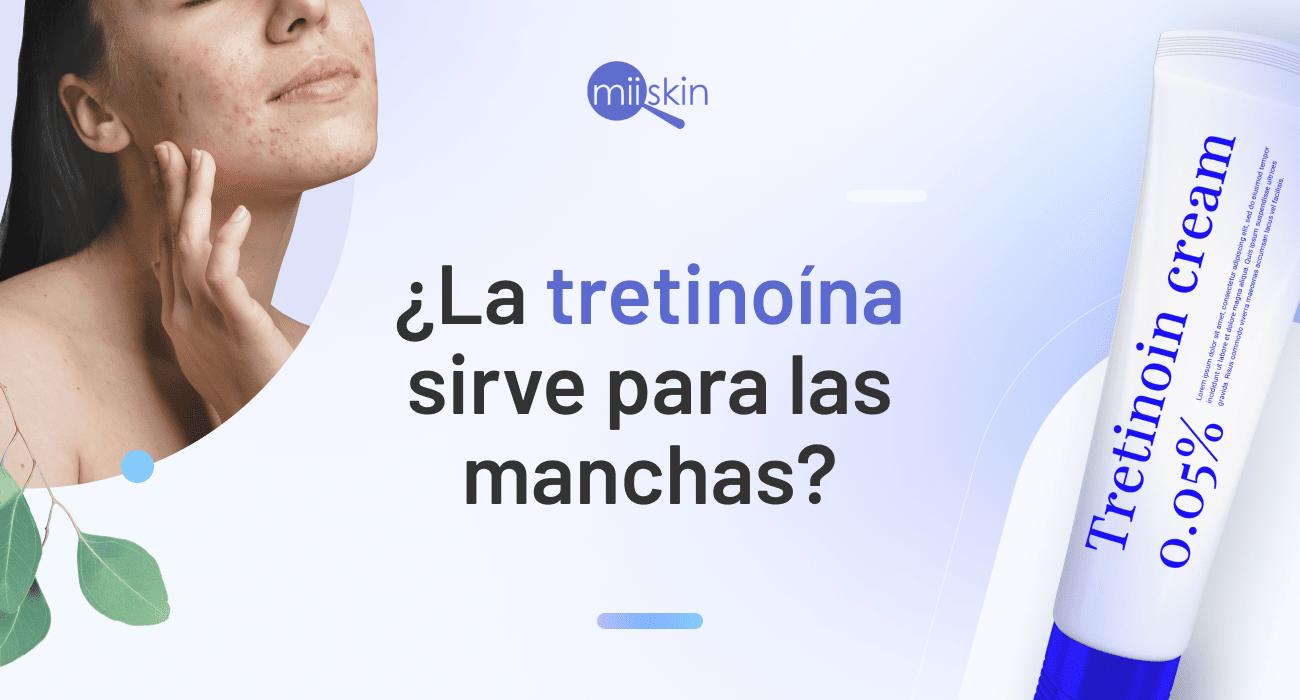 para que sirve triamcinolone 0.1