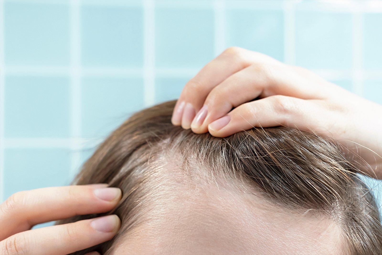 peptide injections for hair growth