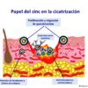 ¿Por qué utilizamos zinc tópico en las heridas y la piel perilesional?